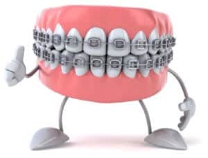 What Is the Cost of Metal Braces? - Central Coast Orthodontics